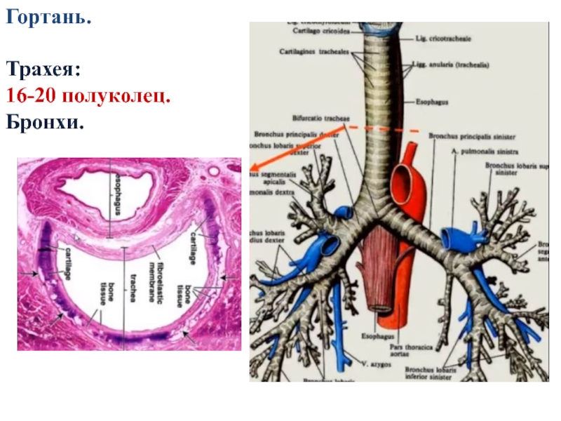 Стенки трахеи. Гортань трахея бронхи. Хрящевые кольца бронхов. Крупный бронх отходящий от трахеи. Бронхи образованы хрящевыми полукольцами.