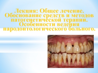 Общее лечение. Обоснование средств и методов патогенетической терапии. Особенности ведения пародонтологического больного