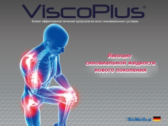 PPT VISCOPLUS