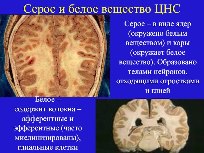 Какую функцию выполняет серое вещество мозга. Что такое белое и серое вещество центральной нервной системы. Белое и серое вещество нервной системы человека. Белое и серое вечещства. Расположение серого вещества в головном мозге.