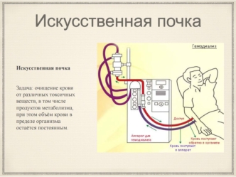 Искусственная почка