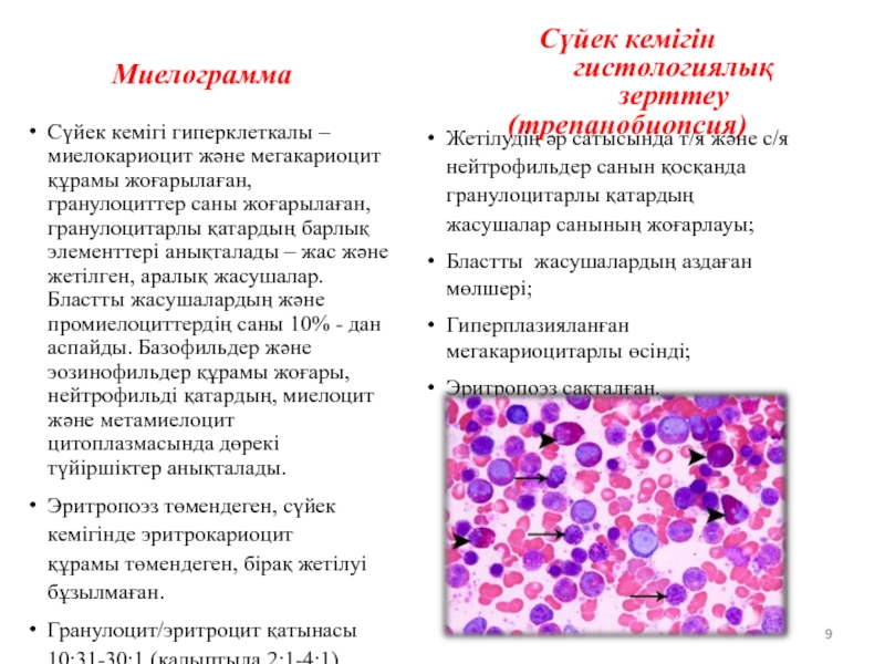 Метамиелоциты это. Миелокариоциты повышены при. Гиалиновые мембраны и мегакариоциты в легких.