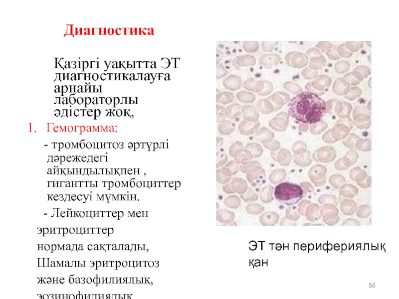 Тромбоцитоз неуточненный