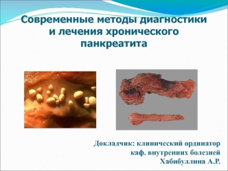 Современные методы диагностики и лечения хронического панкреатита