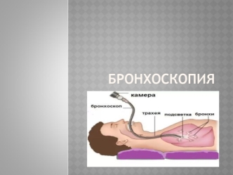 Бронхоскопия. Последствия и осложнения фибробронхоскопии