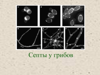 Септы у грибов