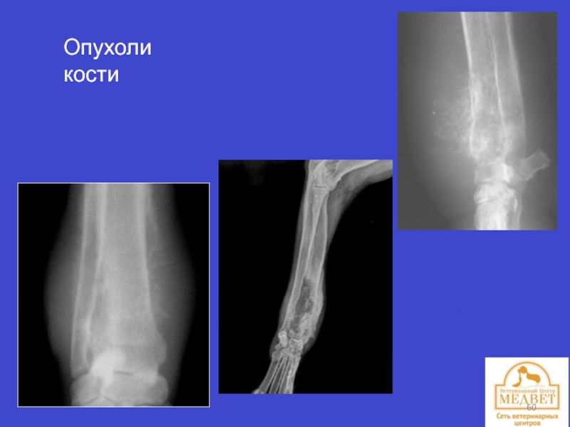 Опухоли костей презентация