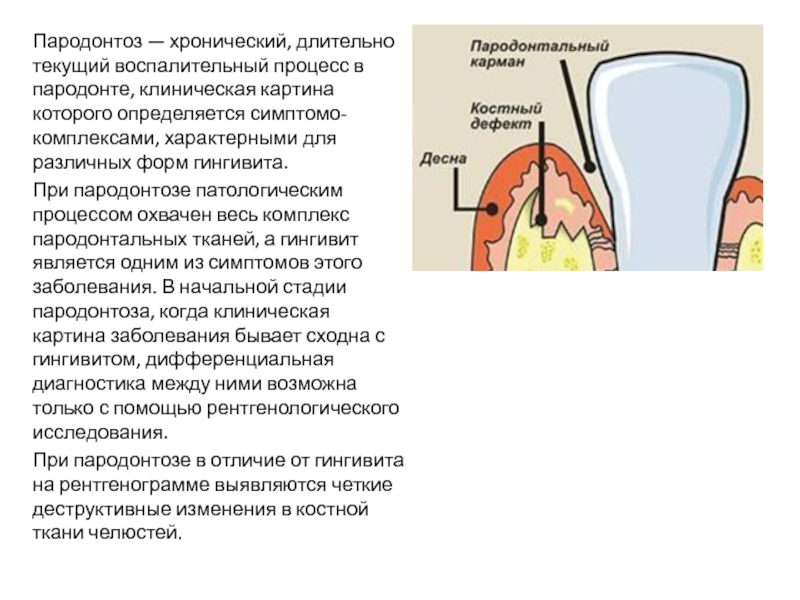 Составление плана лечения пациентов с патологией пародонта воспалительного генеза презентация