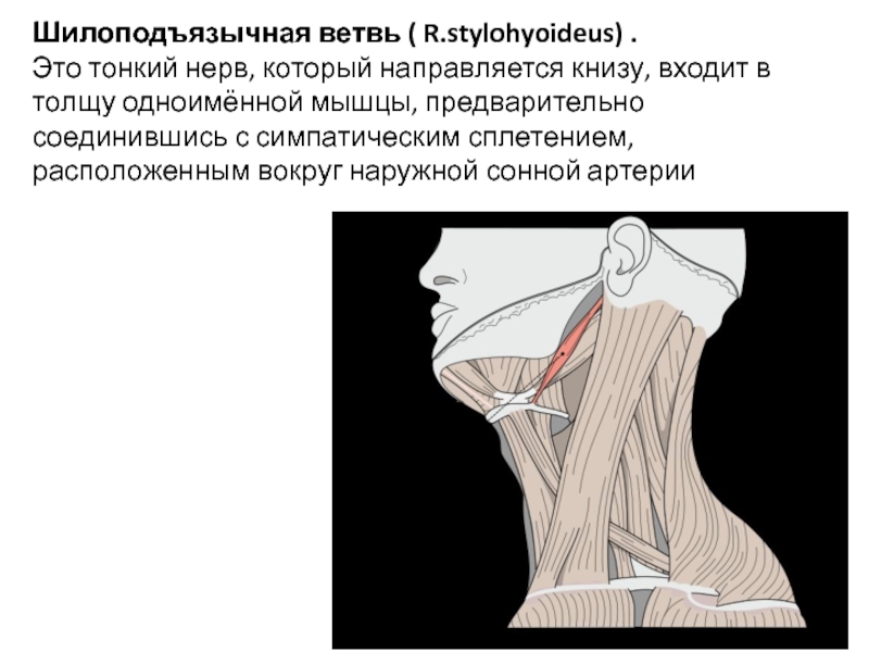 Шилоподъязычный синдром фото