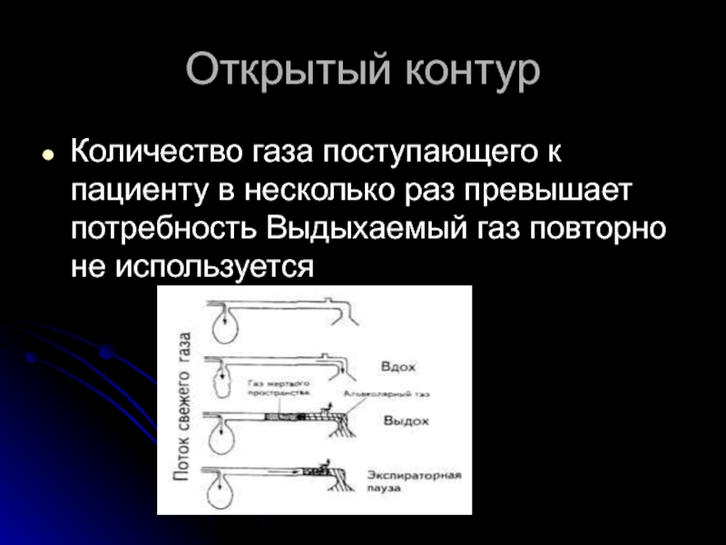 Закрытый контур. Открытый контур. Открытый контур характеризуется анестезия. Открытый контур характеризуется хирургия. Открывание контуров.