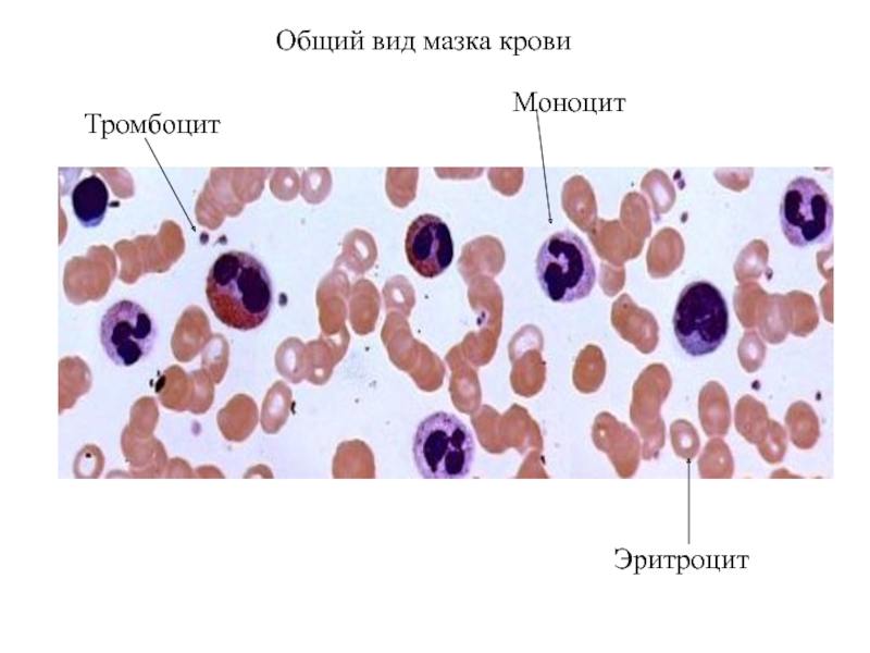 Тромбоциты в мазке крови фото