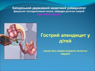 Острый аппендицит или воспаление червеобразного отростка