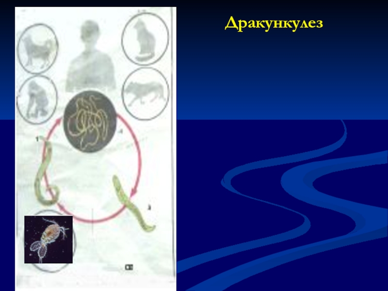 Что изучает гельминтология. Дракункулез (болезнь ришты). Дракункулез презентация. Частная гельминтология микробиология. Медицинская гельминтология.