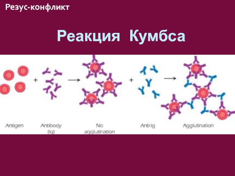 Реакция кумбса. Резус конфликт реакция Кумбса. Реакция Кумбса схема. Реакция Кумбса компоненты реакции.