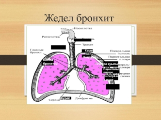 Жедел бронхит