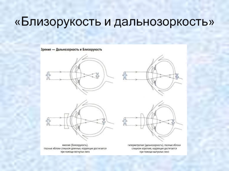 Определение близорукости и дальнозоркости