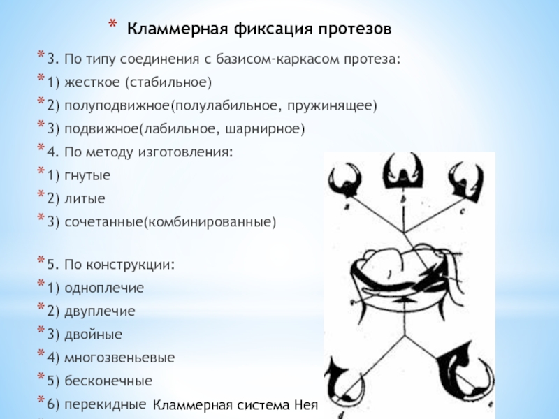 Кламмерная фиксация протеза