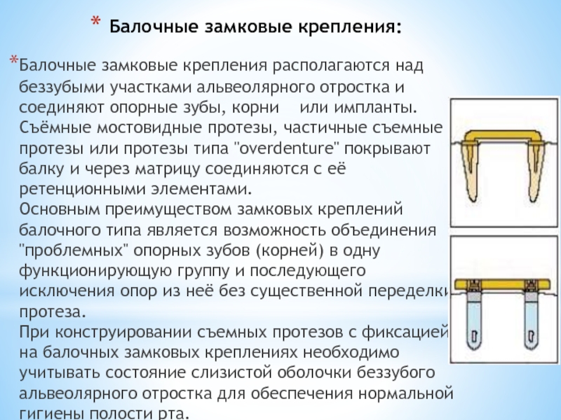 Съемные ортопедические конструкции презентация