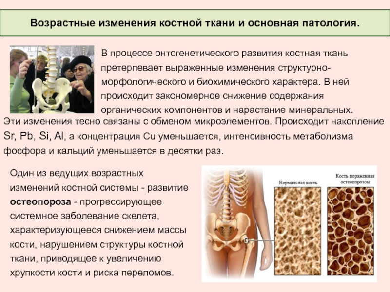 Признаком возрастных изменений костей является. Изменение костной ткани. Возрастные изменения кости. Возрастные изменения пластинчатой костной ткани. Возрастные изменения скелета человека.