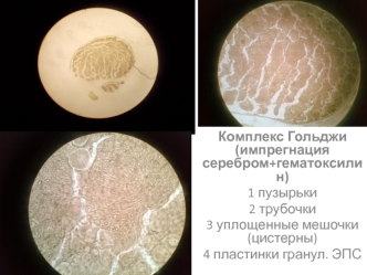 Комплекс Гольджи (импрегнация серебром+гематоксилин)