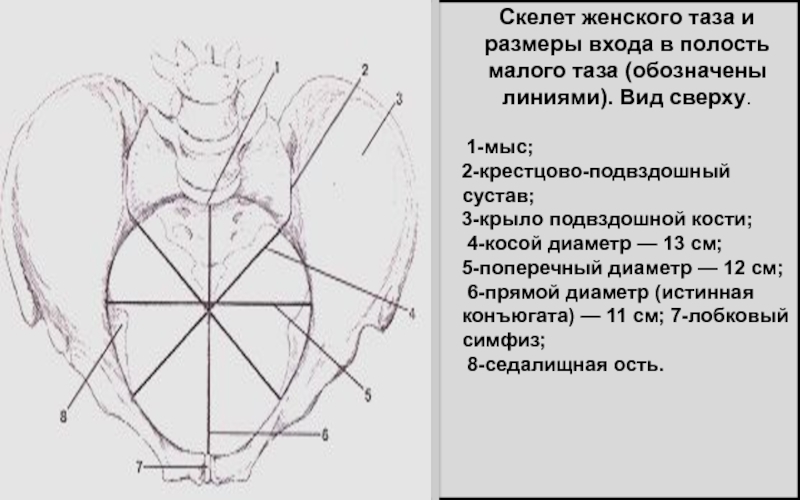 Размеры полости. Прямой диаметр входа в малый таз. Поперечный диаметр входа в малый таз. Малый косой размер таза. Косой размер входа в малый таз.