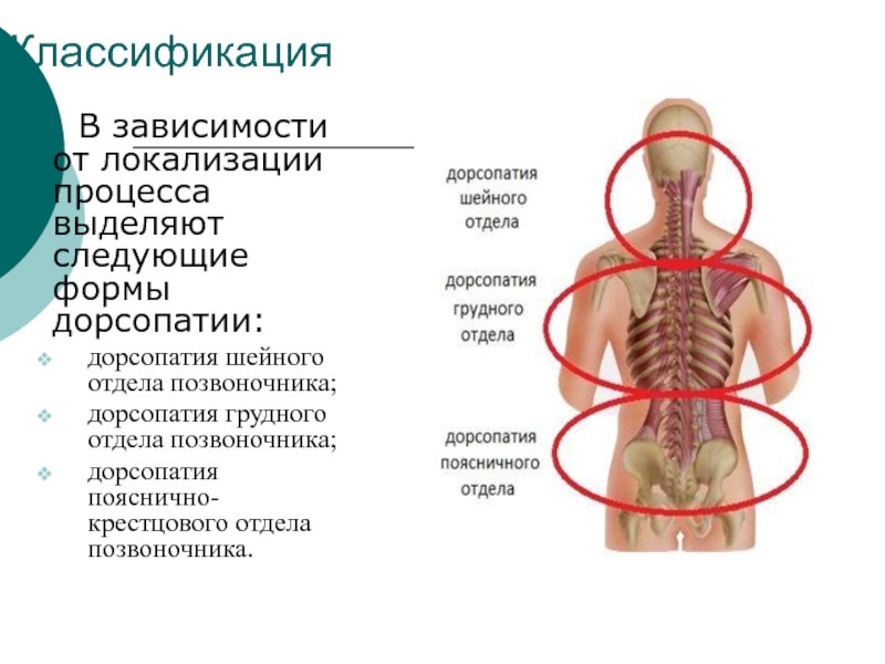 Дорсопатия грудного отдела позвоночника карта вызова