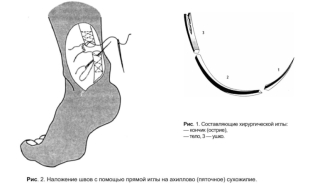 Sutures by Semenov