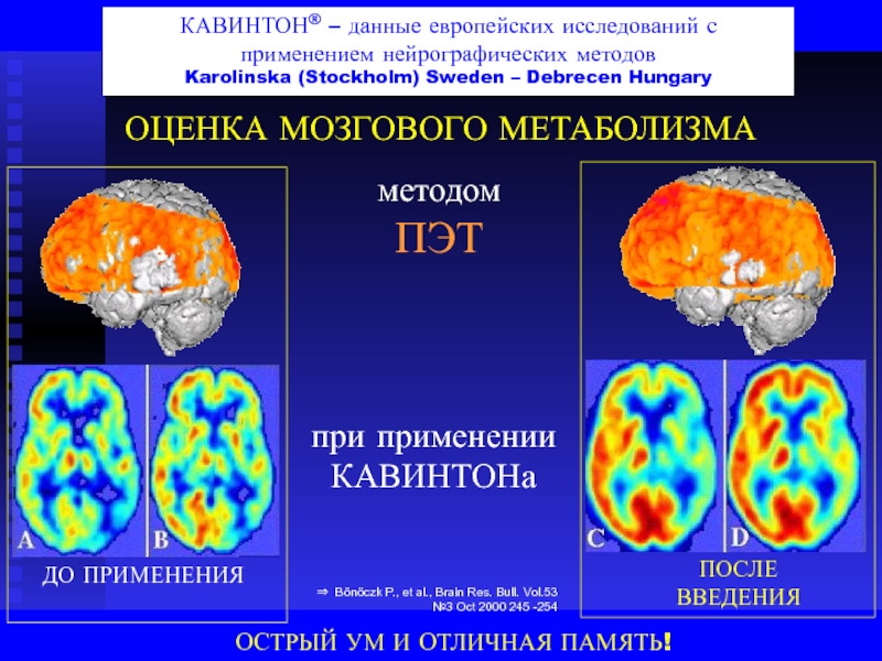 Al brain. ПЭТ головного мозга. Аппарат для исследования энергообмена головного мозга. Острый ум 7+. Сушан острый ум Эйдолны.
