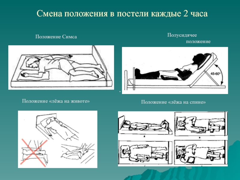 Смена положения защелки edson