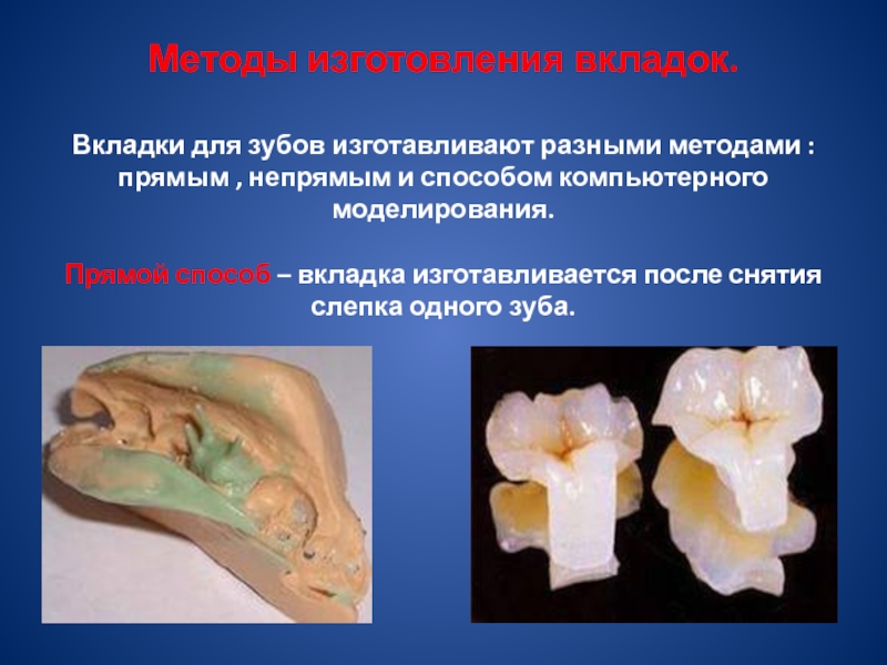 Способ компьютерного фрезерования вкладок