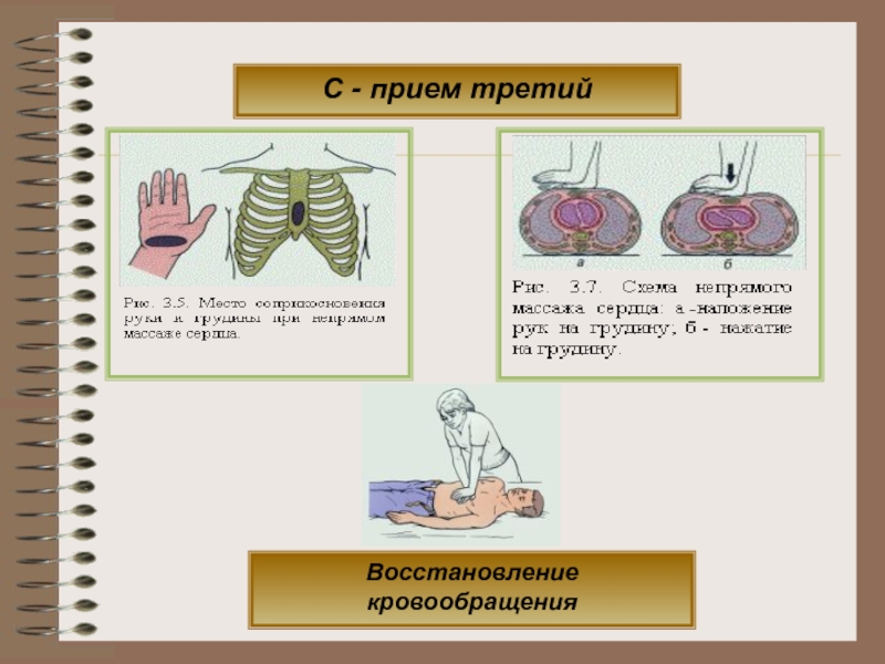 Прием три варианта