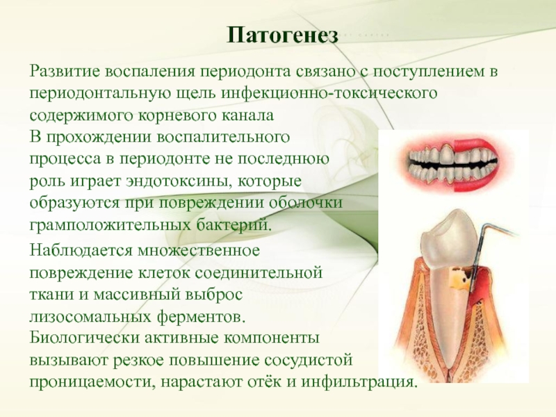 Пародонт особенности. Основные заболевания зубов. Презентация заболевание зубов. Развитие периодонта. Этапы развития периодонта.