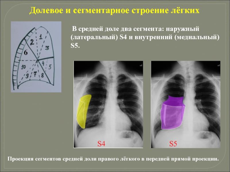 Схема сегментов легких на рентгене