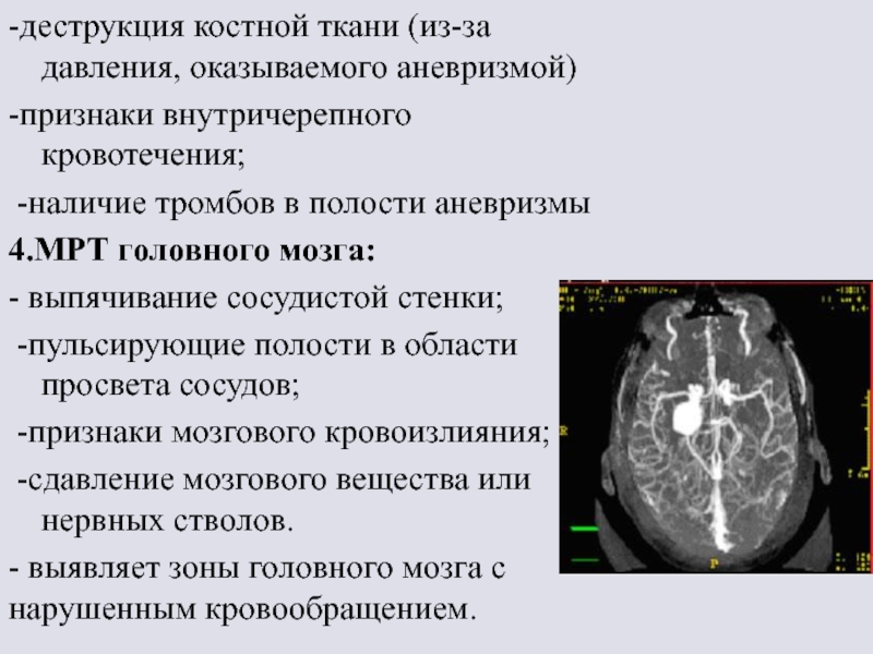 Косвенное внутричерепная гипертензия. Аневризма головного мозга. Аневризмы сосудов головного мозга. Аневризм головного мозга. Аневризм артерий головного мозга.
