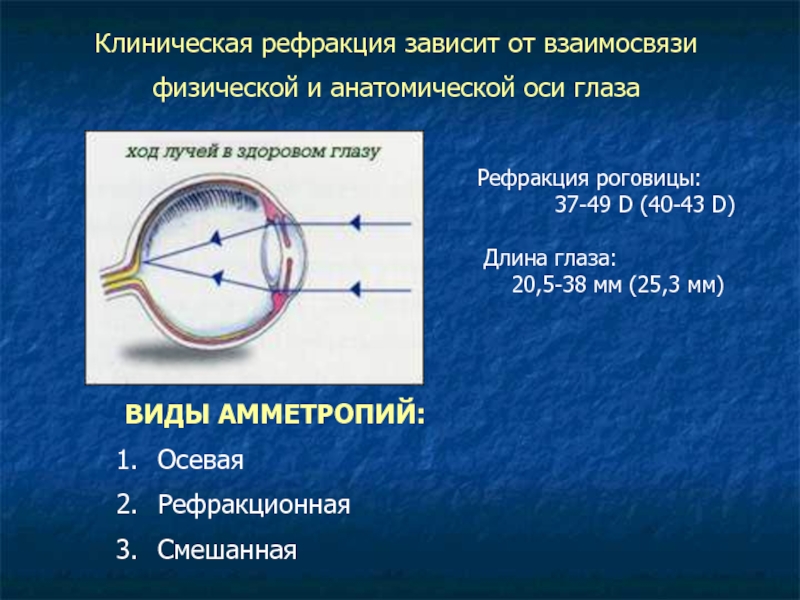 Презентация аномалии рефракции