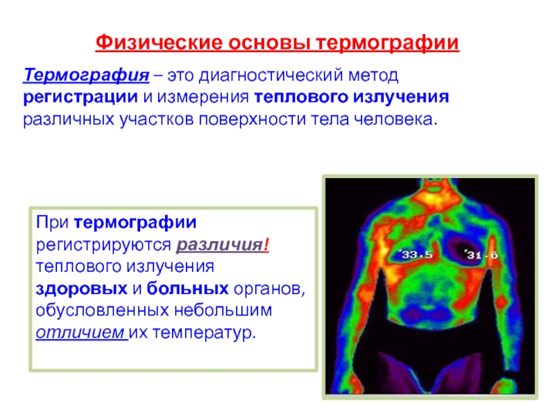 Медицинская термография презентация