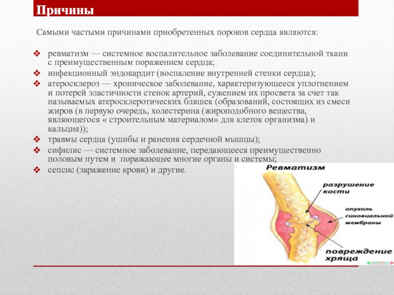 Ревматизм и пороки сердца презентация