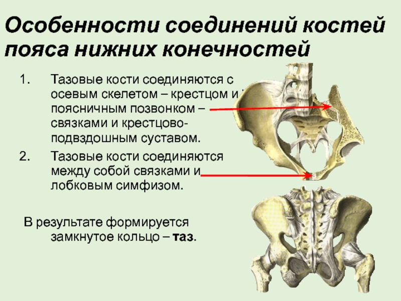 Изменения костей таза. Крестцово подвздошный сустав анатомия строение. Соединение костей таза анатомия. Подвздошной кости внутренняя структура. Кости таза подвздошная кость.