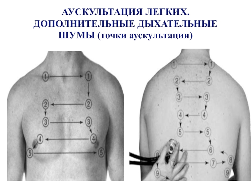 Схемы основных дыхательных шумов