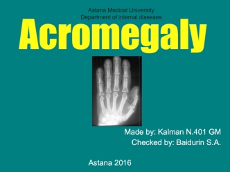 Acromegaly. Description