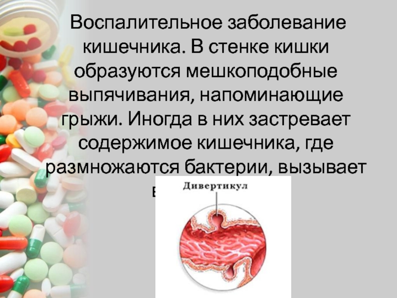 Сестринский процесс при заболеваниях пищеварения. Воспалительные заболевания кишечника. Сестринский процесс при заболеваниях органов пищеварения. Болезни кишечника названия список. Какие воспалительные процессы могут быть в кишечнике.