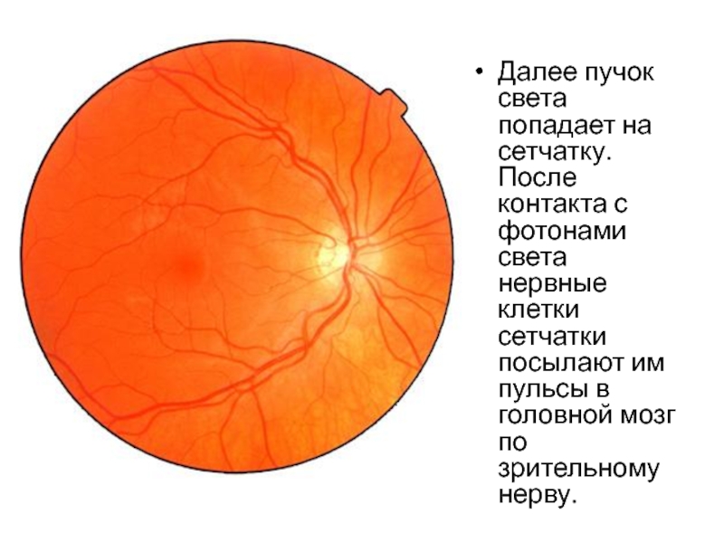 Норма глазного дна. Глазное дно норма офтальмология. Глазное дно норма рисунок. Глазное дно при офтальмоскопии норма.