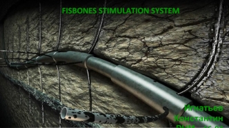 Fisbones stimulation system. Конструкция