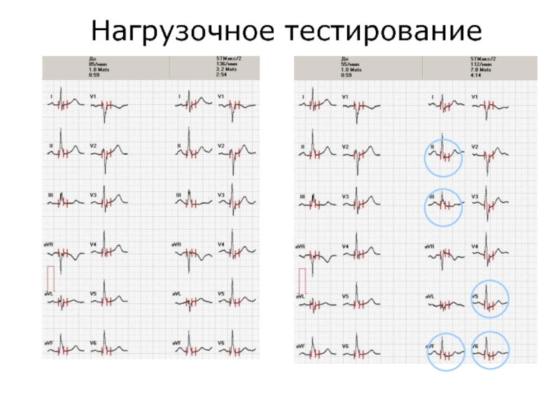 Физические основы электрокардиографии презентация