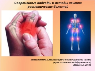 Современные подходы и методы лечения ревматических болезней