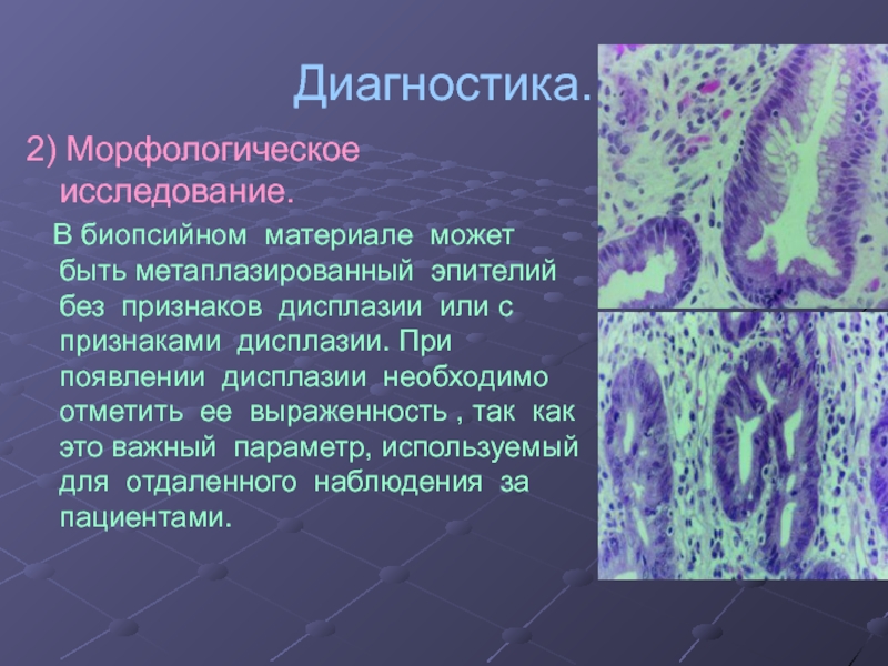 Что означает морфологическая картина