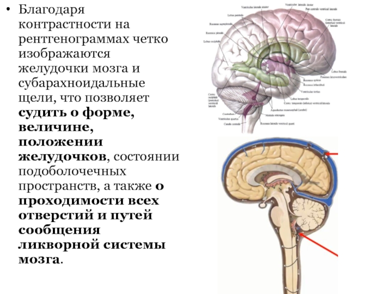 Мр картина умеренного неравномерного расширения субарахноидального конвекситального пространства