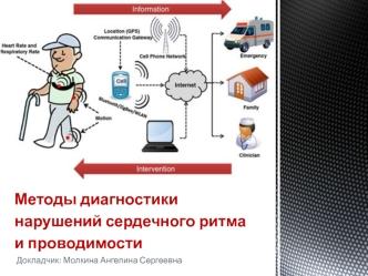 Методы диагностики нарушений сердечного ритма и проводимости