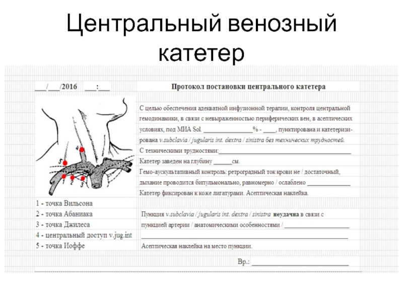 Катетеризация центральной вены