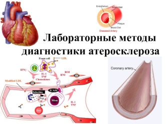 Диагностика атеросклероза